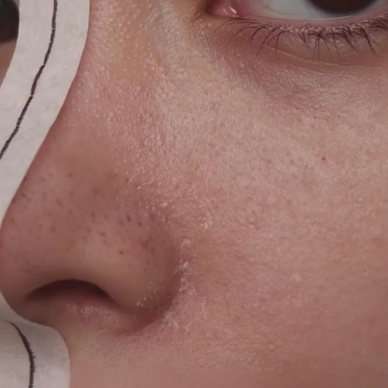 Peel Shot Coréen - Éclat immédiat, peau parfaite!